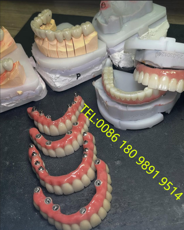 深圳种植体加工服务、CE认证种植牙代工