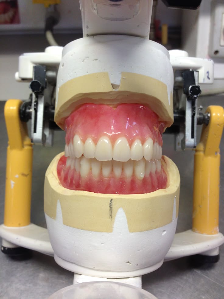 假牙活动义齿出口到加拿大原来那么简单