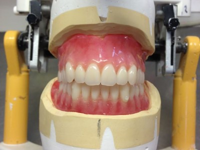 假牙活动义齿出口到加拿大原来那么简单