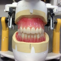 假牙活动义齿出口到加拿大原来那么简单